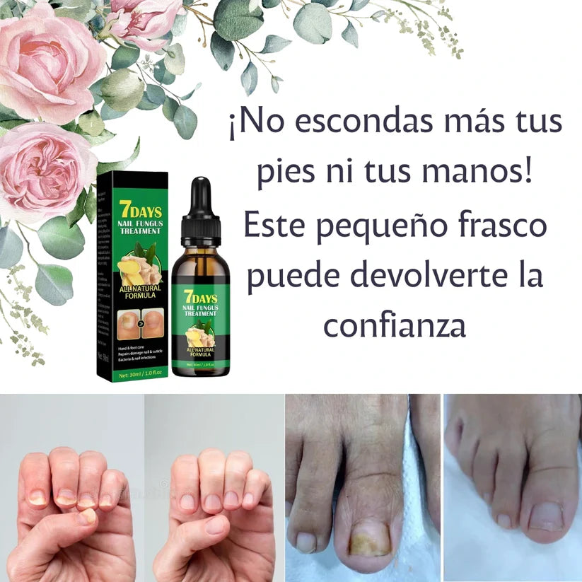 Clara‑Pure™ – Esencia Antihongos para Uñas