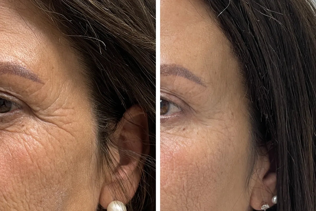 LumiFirm™ Serum Mágico de Juventud – Firmeza y Brillo Instantáneos