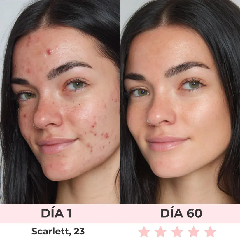 CLARA TIERRA 7-EN-1 Escultor Facial LED