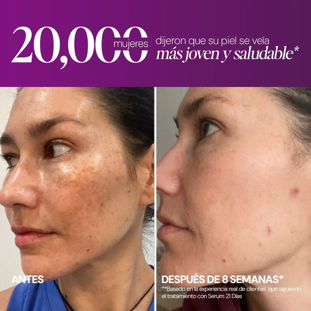 Suero 21 Días - Chau manchas. Volvé a brillar. Volvé a ser vos.