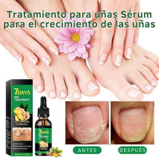 Uñas Libres – Confianza en 7 Días