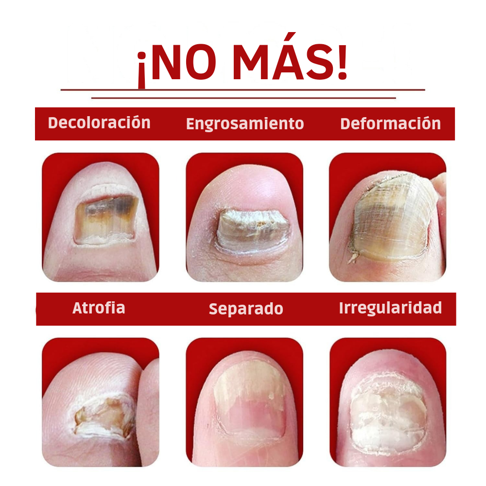 Uñas Libres – Confianza en 7 Días