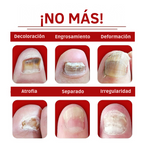 Uñas Libres – Confianza en 7 Días