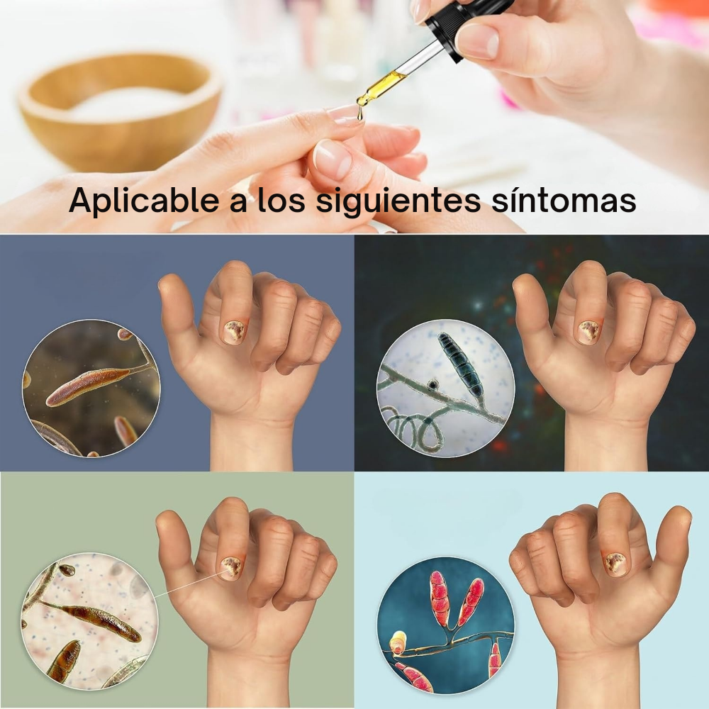 Uñas Libres – Confianza en 7 Días