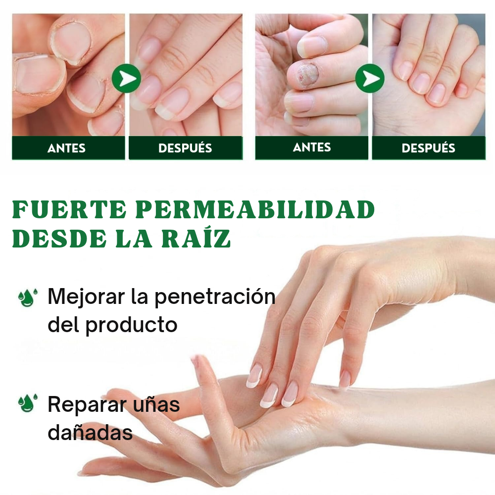 Uñas Libres – Confianza en 7 Días
